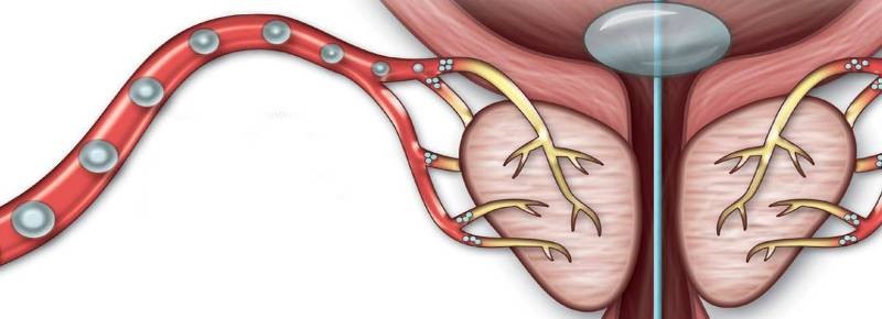 arterias de la próstata